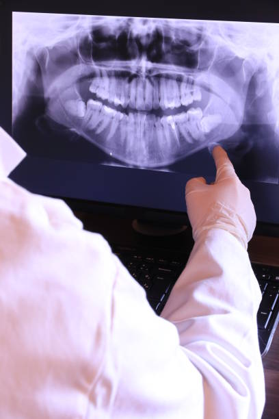 Best Emergency Dentist for Knocked-Out Tooth in Myrtle Beach, SC